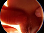 My clit takes a peek at the sun 13/16