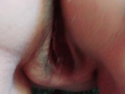 Moisturising my bottom 13/16