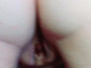 Moisturising my bottom 15/16