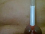 Urethral insertion with pen 12/16