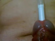 Urethral insertion with pen 3/16