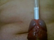 Urethral insertion with pen 4/16