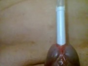 Urethral insertion with pen 8/16