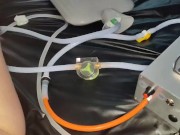 Enema machine and inflatable nozzle are filling my ass 1/16