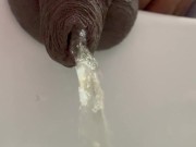 Pissingwithforeskin 4/16