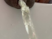 Pissingwithforeskin 7/16