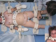 Sweet Peaches asylum patient electroshock multiple orgasm therapy 14/16