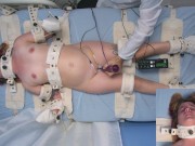 Sweet Peaches asylum patient electroshock multiple orgasm therapy 16/16