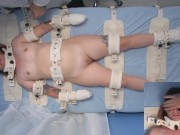 Sweet Peaches asylum patient electroshock multiple orgasm therapy 2/16