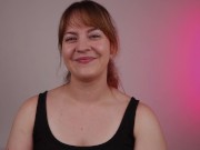 Sex Toy Review - ShotsExquisite Vulva & Breast Pump with Vibrating and Licking Tongue 16/16