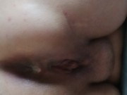 Farting cum from my bum 16/16