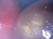 📷 INSIDE ASS POV: The Eggs disappeared in the hole ... 🍑 - Preview 10/16