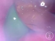 📷 INSIDE ASS POV: The Eggs disappeared in the hole ... 🍑 - Preview 13/16