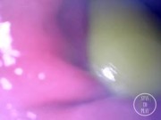 📷 INSIDE ASS POV: The Eggs disappeared in the hole ... 🍑 - Preview 3/16