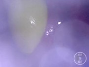 📷 INSIDE ASS POV: The Eggs disappeared in the hole ... 🍑 - Preview 4/16