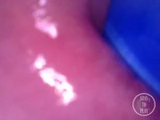 📷 INSIDE ASS POV: The Eggs disappeared in the hole ... 🍑 - Preview 6/16