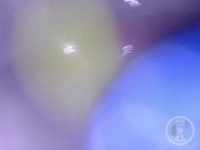 📷 INSIDE ASS POV: The Eggs disappeared in the hole ... 🍑 - Preview 7/16