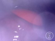 📷 INSIDE ASS POV: The Eggs disappeared in the hole ... 🍑 - Preview 9/16