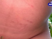 Two Times ako Pinutukan Ni BF - AngelineCruz 12/16