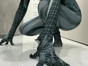 A young 18-year-old girl showed an anal web 1/16