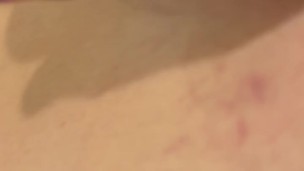 Anal Gape