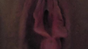 Queefing after surgery