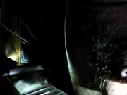 with a torch wringly foreskin 6/16