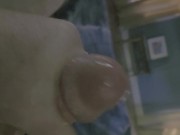 Shot in the eye 12/16