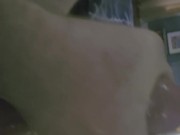 Shot in the eye 15/16