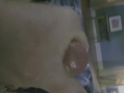 Shot in the eye 16/16