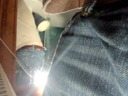 foreskin standing there 14/16