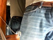 foreskin standing there 7/16