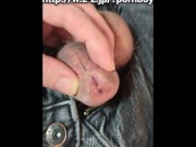 尿道下裂公開 16/16