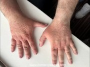 Sisters arm and hand trampling 15/16