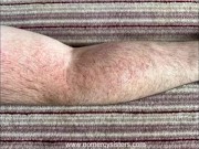 Sisters arm and hand trampling 16/16