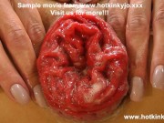 Legendary double fisting queens Hotkinkyjo & Dirtygardengirl have fun together & anal prolapse 15/16