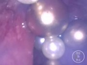 CAM INSIDE ASS: The Balls disappeared deep inside my hole ⚽⛓ - Preview 5/16