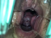 Jack stretches Tawny's hairy pussy with a speculum to get her ready for mmf with a bwc 2/16