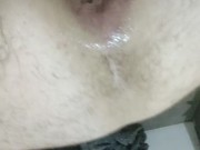 Anal solo extremo 5/16