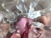 Close up camera in pussy. Sweet Cum inside pussy. 1/16