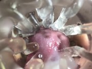 Close up camera in pussy. Sweet Cum inside pussy. 16/16