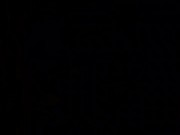 showing my tits in the park. 7/16