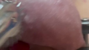 Shark teeth on besties balls