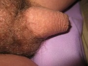 My hairy tiny dick with one testicle