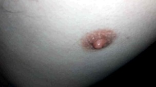 My body (1) with one testicle