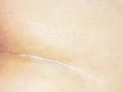 Anal sex hurts me 15/16