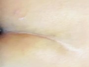 Anal sex hurts me 8/16