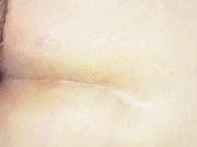 Anal sex hurts me 9/16