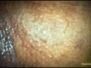 Husband Put Dildo Inside Pussy And Licking He Cant Satisfy His Horny Slut කෙදිරි ගෑවෙන්නම සැප 7/16