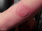 Hard Femdom Biting Session with my Submissive 10/16